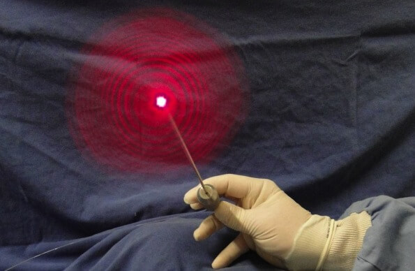 Lipoaspiração a Laser - Como Funciona e Dicas - MundoBoaForma