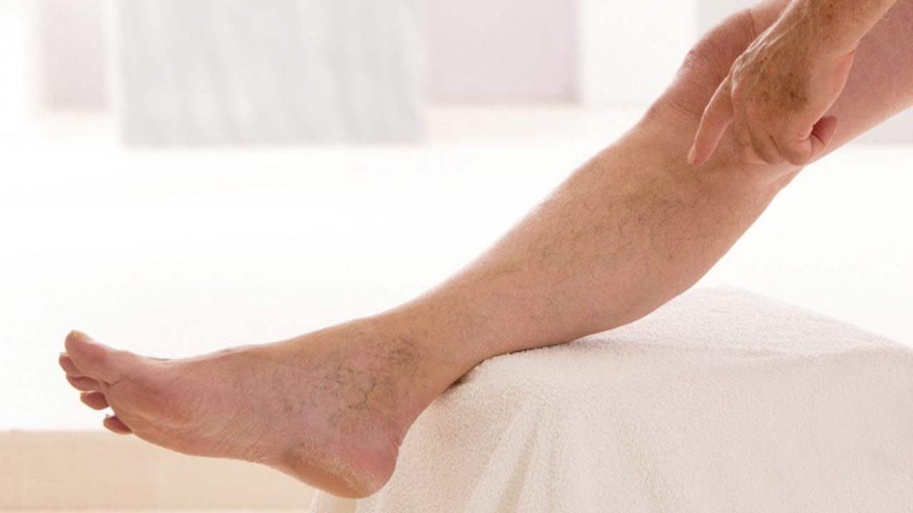 como clarear connective tissue pelos das pernas naturalmente