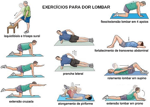 mundo-sem-dor-exercicios-dor-lombar