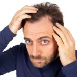 12 remédios para queda de cabelo mais famosos homem com queda de cabelo