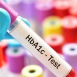 HbA1c