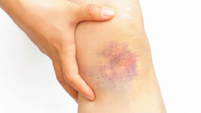 Dor muscular piriforme pior à noite