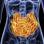 Infecção intestinal