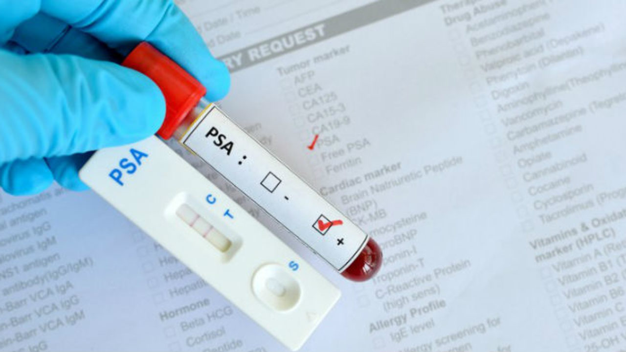 exame de blood de prostate