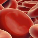 5 principais sintomas da anemia - O que é e sinais importantes