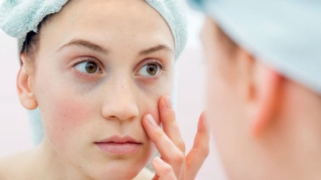 lupus sintomas iniciais de diabetes