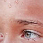 10 Dicas para a sua Pele Sofrer Menos Com a Acne Pós-Treino