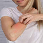 Woman Scratching an itch on white background . Sensitive Skin, Food allergy symptoms, Irritation