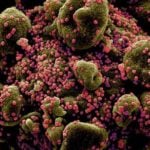 Imagens de Microscópio Mostram o Novo Coronavírus Atacando Célula Humana