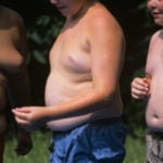 Obesidade Pode Ser "Contagiosa" Entre Adolescentes, Diz Estudo - Entenda!