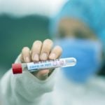 Como São os Diferentes Tipos de Testes Para Detectar o Novo Coronavírus