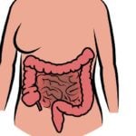 Síndrome do Intestino Permeável - O Que é e Como Tratar