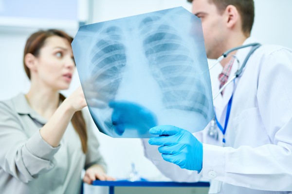 radiografia-dos-pulmões-para-tuberculose