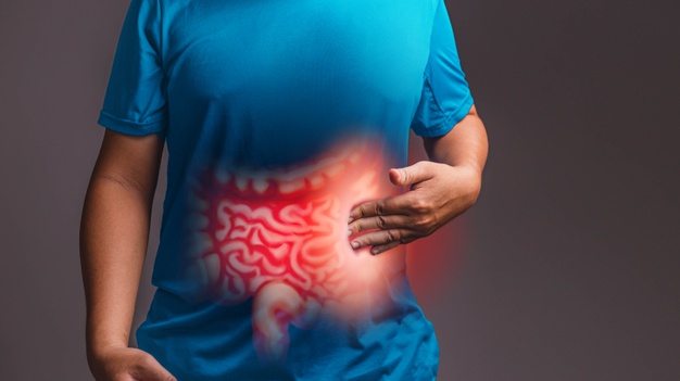 sindrome do intestino irritável