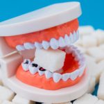 Alimentos ruins para os dentes - Quais são?