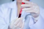 Como afinar o sangue naturalmente: 15 dicas - MundoBoaForma
