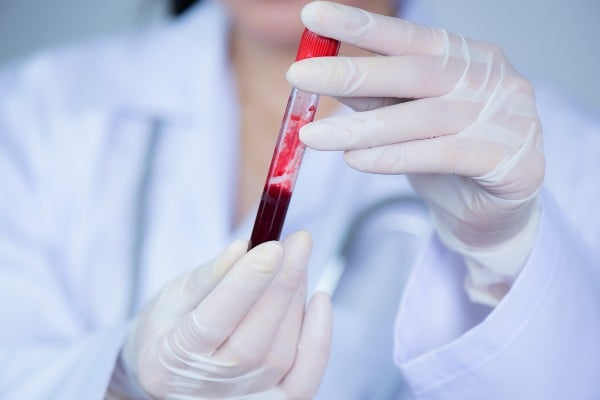 amostra de sangue para contagem de plaquetas