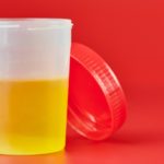 Exame de urina - Para que serve e como é o preparo
