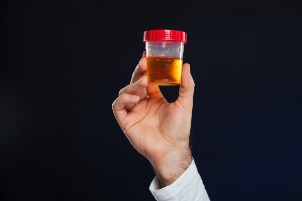 médico segurando amostra de urina
