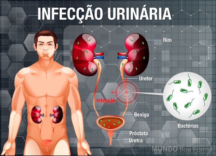 infecção urinária masculina