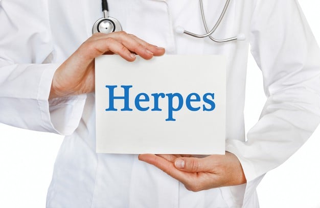 Diagnóstico de herpes