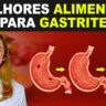 melhores alimentos para gastrite