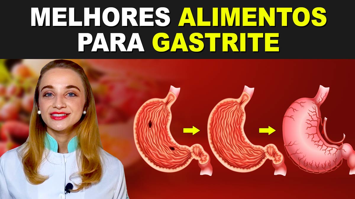 [VÍDEO] Melhores alimentos para gastrite e dicas importantes ...