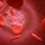Anemia falciforme: o que é, causa, sintomas e tratamentos
