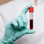 Exame de anemia