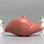 Biópsia do fígado: para que serve e como é feita