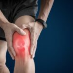 Como tratar a dor no joelho após a corrida?