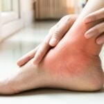 Tendinite nos tornozelos: o que é, sintomas, causas e tratamentos
