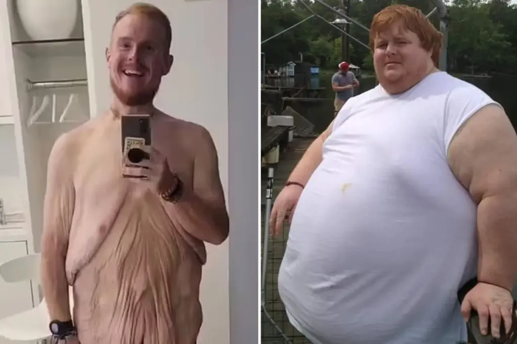 Casey King - Antes e depois