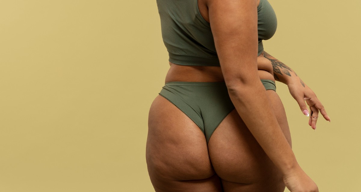 Como tirar celulite com tratamentos est&eacute;ticos - MundoBoaForma