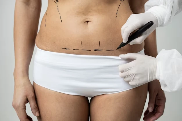 Cirurgia plástica na barriga