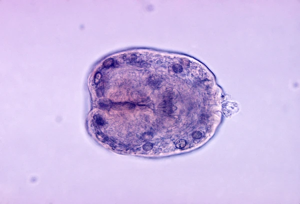 Echinococcus granulosus