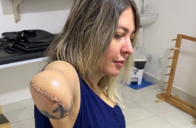 Camila Gama, tatuadora já com o braço amputado
