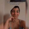 Natasha tem parte removida do crânio por causa da sinusite.