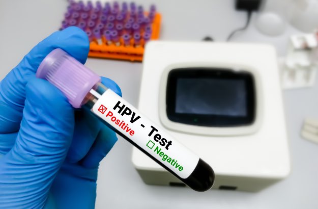 Autoteste HPV, médico ou técnico de laboratório segurando amostra de sangue para teste de papilomavirus humano. 