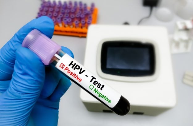 Autoteste HPV, médico ou técnico de laboratório segurando amostra de sangue para teste de papilomavirus humano. 