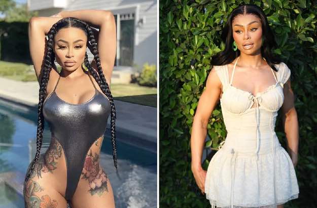 Blac Chyna realiza explante de silicone e preenchimentos.