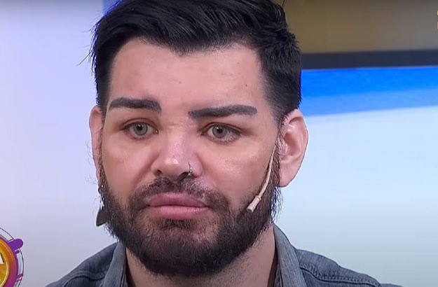 Fran Mariano faz 30 cirurgias para se parecer com Ricky Martin
