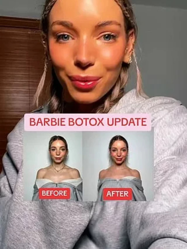 Barbie Botox, o procedimento estético que é a nova tendência da Internet