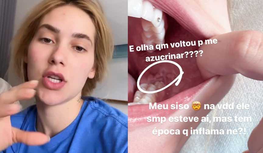 Virginia Fonseca dente do siso, Instagram 