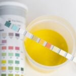 Novo teste de urina em papel facilita detecção precoce de câncer