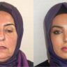 Mulher turca antes e depois