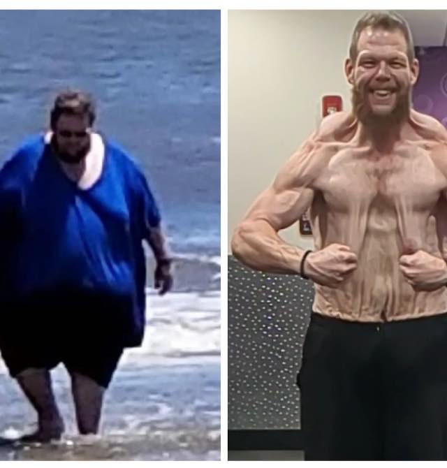 Cole perdeu 150 kg, antes e depois 