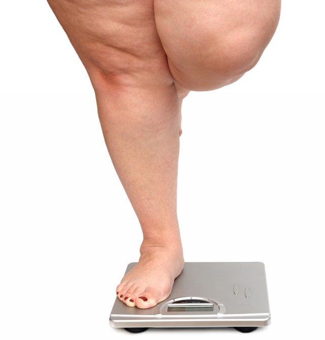 Pernas de uma mulher com excesso de peso em cima de uma balança