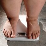 Obesidade e pés de mulher com excesso de peso