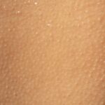 Pele humana, fotografia bem aproximada